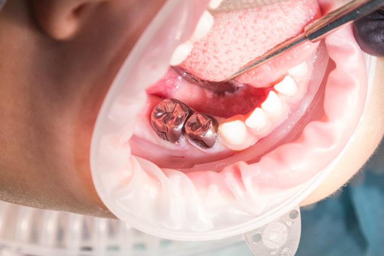 Грудастая телка-стоматолог трахнула своего пациента прямо в кабинете